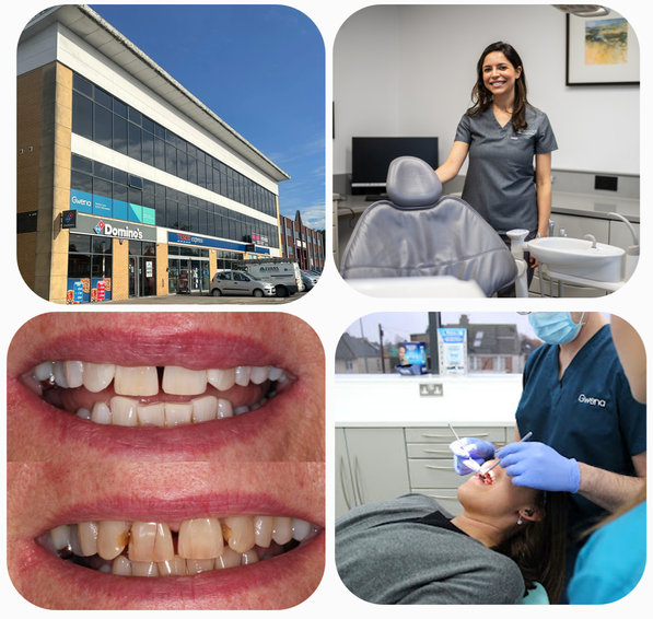 Gwena Dental Care clinic and patient results