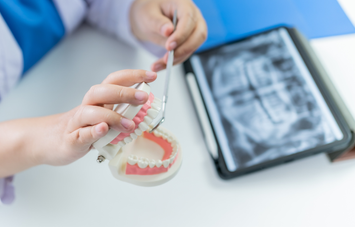 Dental X-Ray